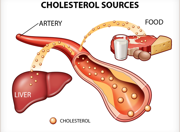 Cholesterol-source